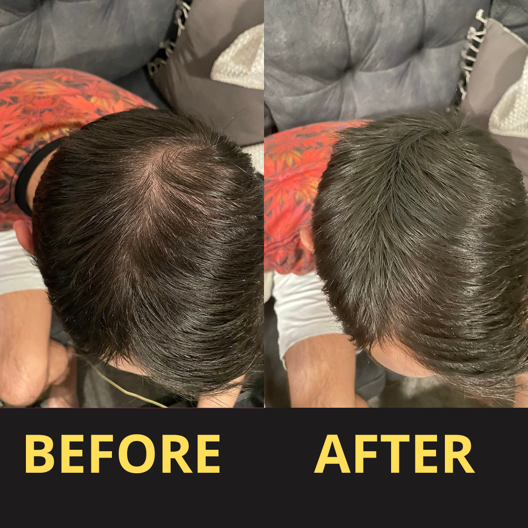 Yagoo Hair Concealer 50ML - Waterproof 3–7 days.