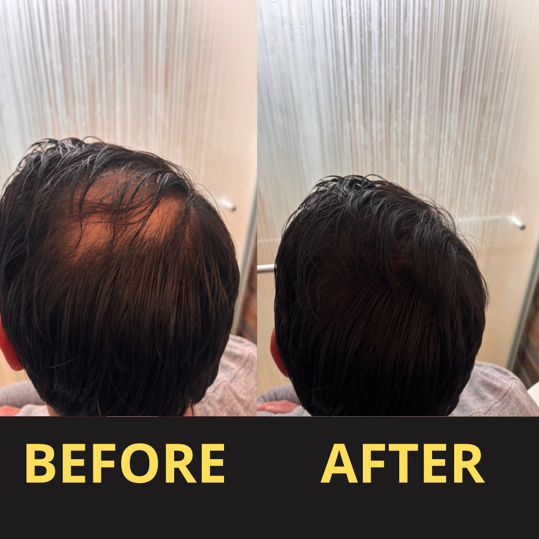 Yagoo Hair Concealer 50ML - Waterproof 3–7 days.