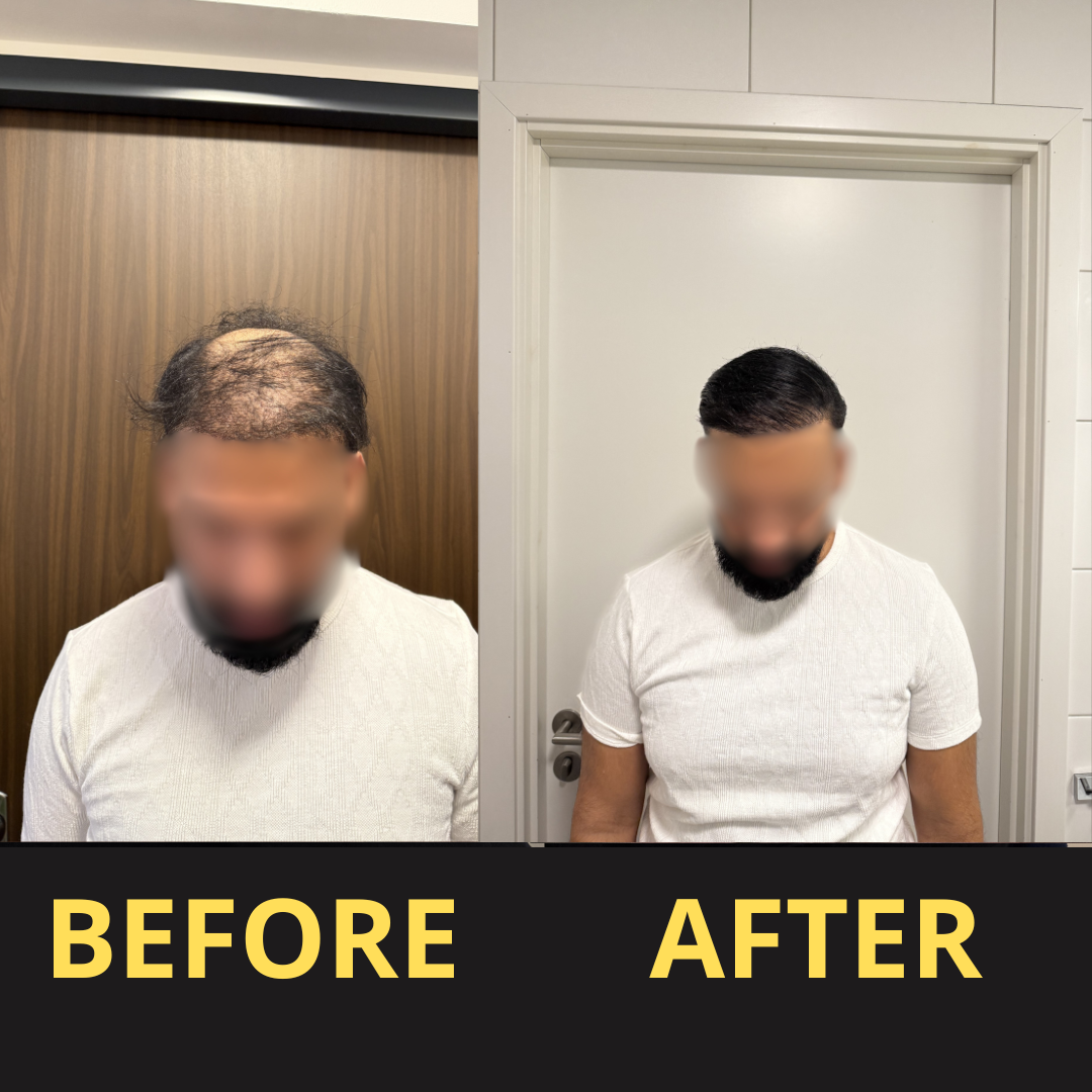 Yagoo Hair Concealer 50ML - Waterproof 3–7 days.